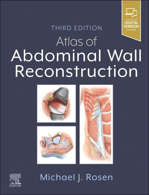 Atlas of Abdominal Wall Reconstruction Elsevier