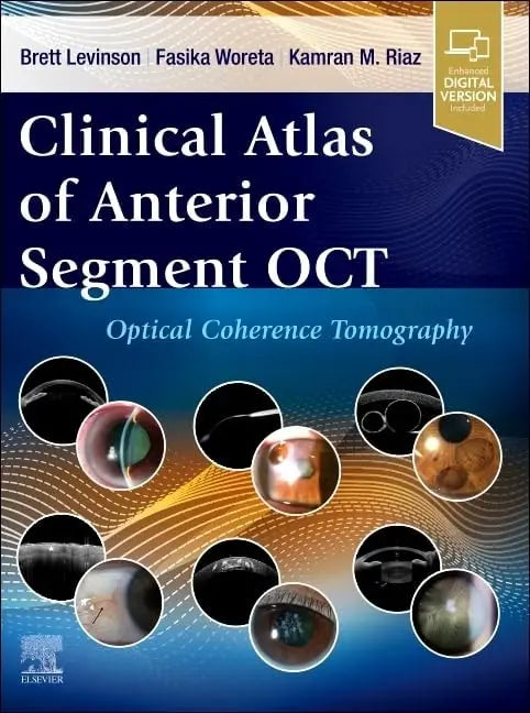 Clinical Atlas of Anterior Segment OCT: Optical Coherence Tomography by Brett Levinson