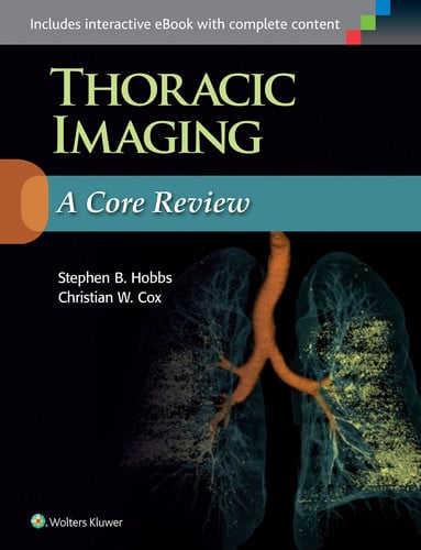 Thoracic Imaging A Core Review by Stephen Hobbs – book cover
