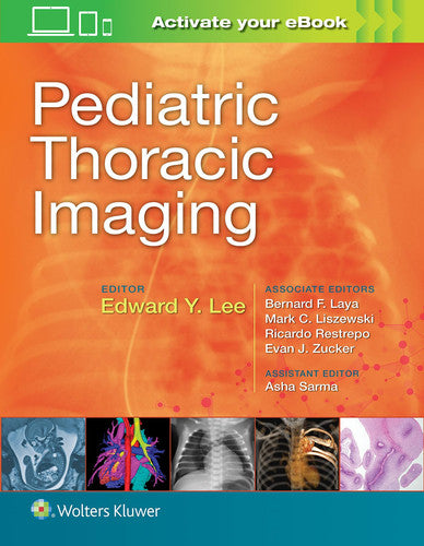 Pediatric Thoracic Imaging by Edward Y. Lee – book cover