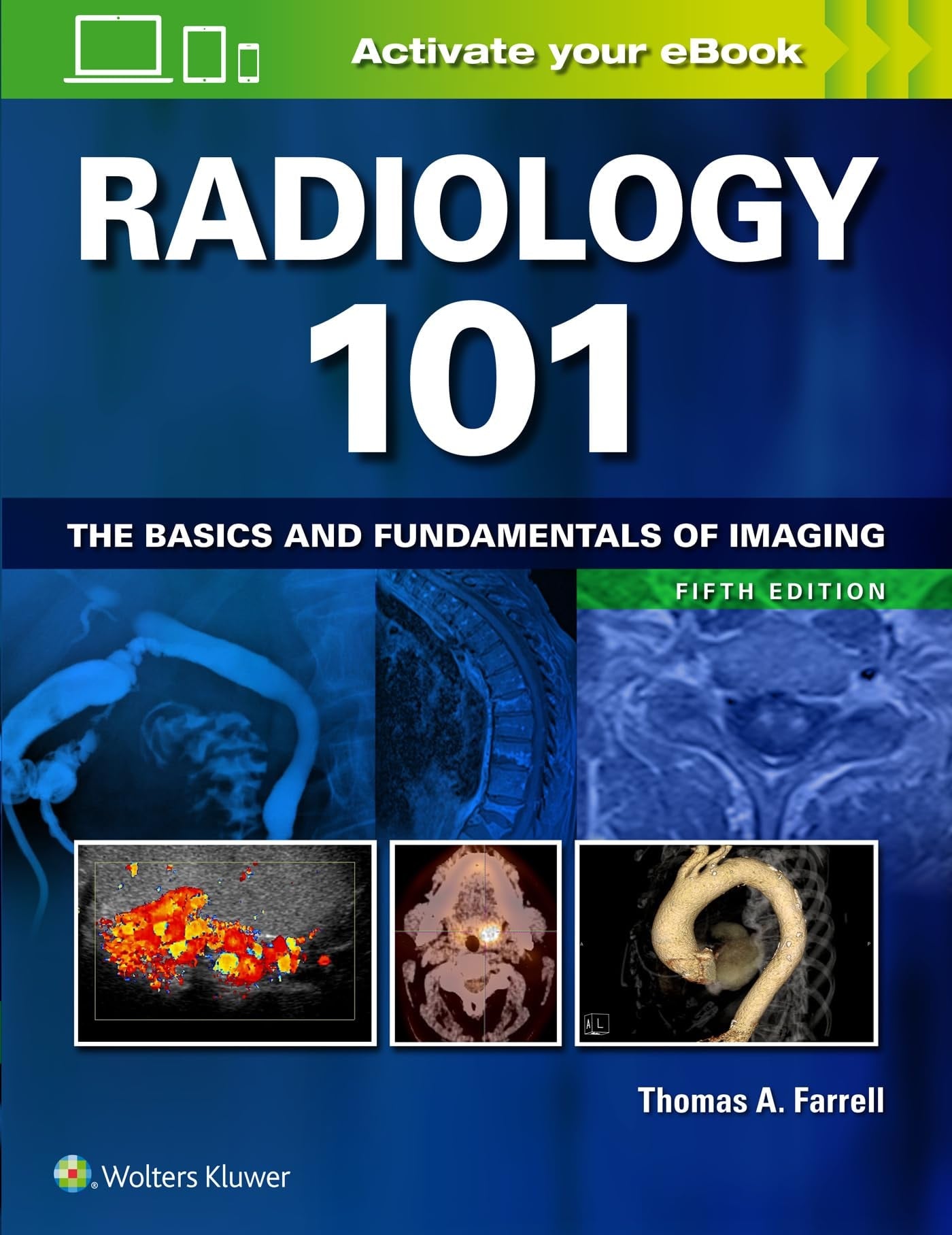 Radiology 101 The Basics and Fundamentals of Imaging by Thomas A. Farrell