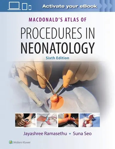 MacDonald's Atlas of Procedures in Neonatology Lippincott Williams & Wilkins