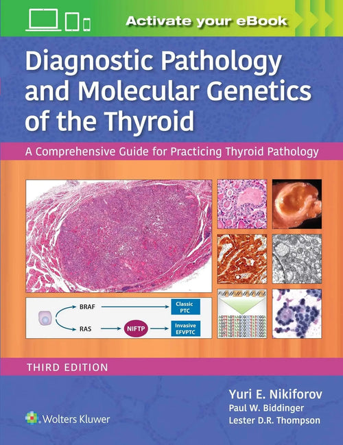 Diagnostic Pathology and Molecular Genetics of the Thyroid A Comprehensive Guide for Practicing Thyroid Pathology by Yuri E. Nikiforov