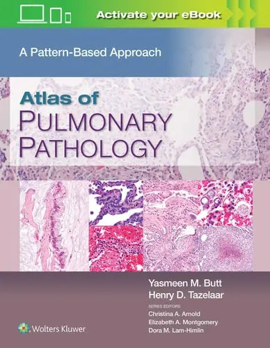 Atlas of Pulmonary Pathology A Pattern Based Approach Wolters Kluwer