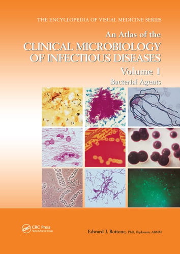 An Atlas of the Clinical Microbiology of Infectious Diseases, Volume 1 Bacterial Agents by Edward J. Bottone – book cover