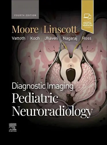 Diagnostic Imaging: Pediatric Neuroradiology Elsevier
