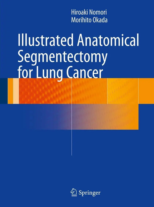 Illustrated Anatomical Segmentectomy for Lung Cancer by Hiroaki Nomori