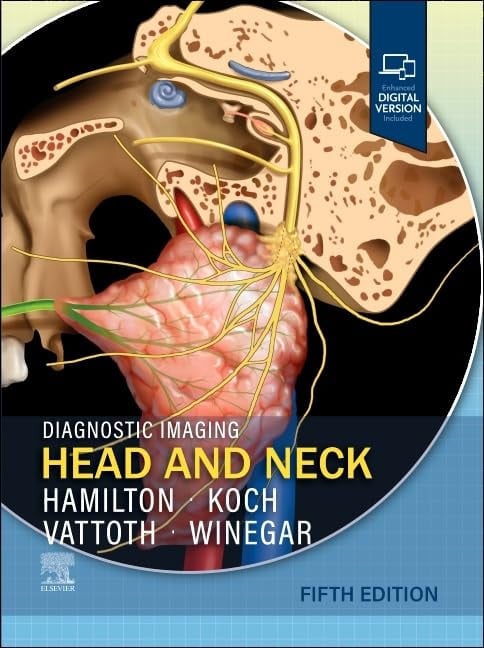 Diagnostic Imaging: Head and Neck Elsevier