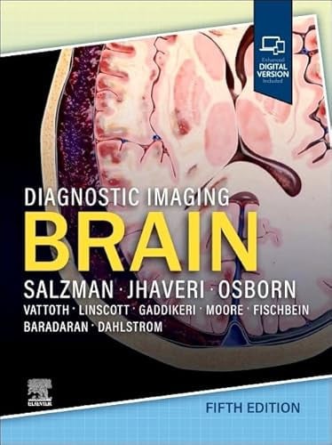 Diagnostic Imaging: Brain Elsevier