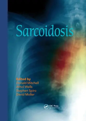 Sarcoidosis by Donald Mitchell