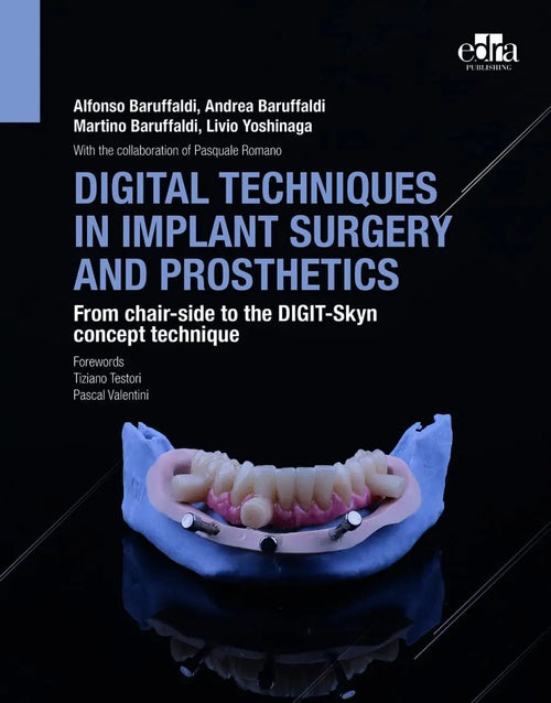 Digital Techniques in Implant Surgery and Prosthetics From Chair-Side to the DIGIT-Skyn Concept Technique by Alfonso Baruffaldi