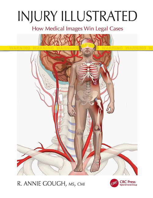 Injury Illustrated How Medical Images Win Legal Cases