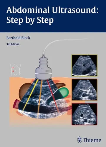 Abdominal Ultrasound Step by Step Thieme