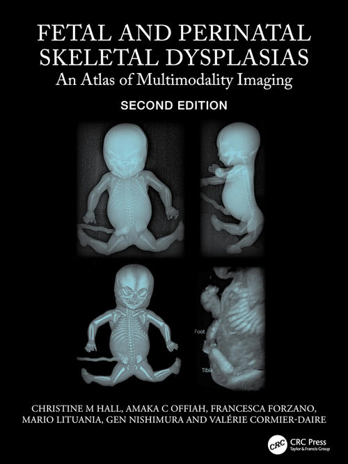 Fetal and Perinatal Skeletal Dysplasias An Atlas of Multimodality Imaging by Christine M. Hall