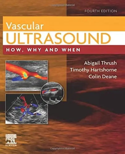 Vascular Ultrasound How, Why and When