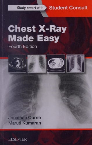 Chest X-Ray Made Easy by Jonathan Corne – book cover