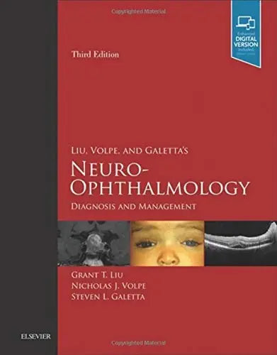 Liu, Volpe, and Galetta's Neuro-ophthalmology Diagnosis and Management Elsevier