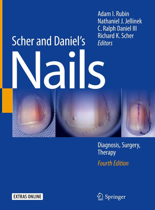 Scher and Daniel's Nails Diagnosis, Surgery, Therapy by Adam I. Rubin
