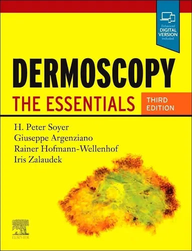 Dermoscopy The Essentials Elsevier