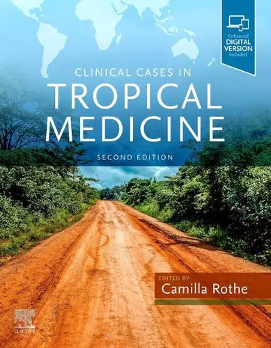 Clinical Cases in Tropical Medicine Elsevier