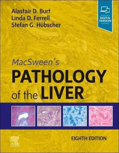 MacSween's Pathology of the Liver Elsevier
