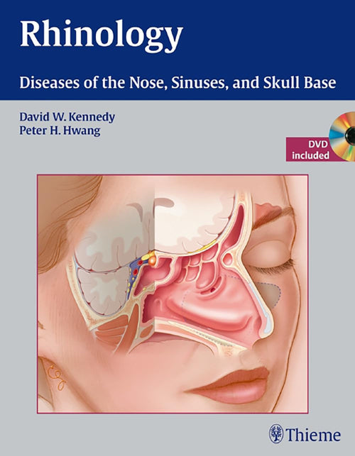Rhinology Diseases of the Nose, Sinuses, and Skull Base