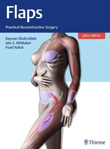Flaps Practical Reconstructive Surgery