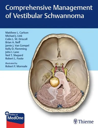 Comprehensive Management of Vestibular Schwannoma Thieme