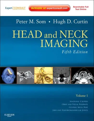 Head and Neck Imaging Mosby Elsevier