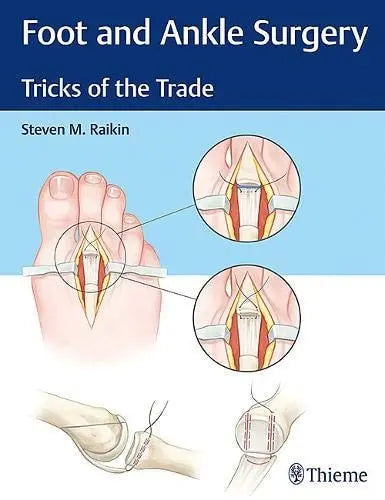 Foot and Ankle Surgery Tricks of the Trade by Steven M. Raikin