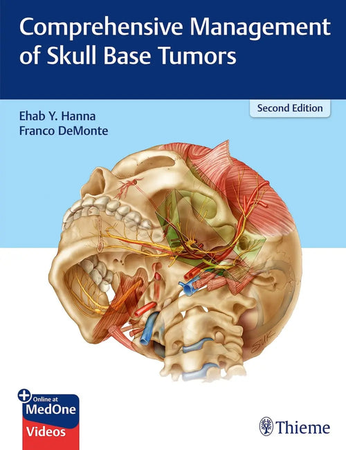 Comprehensive Management of Skull Base Tumors by Ehab Y. Hanna