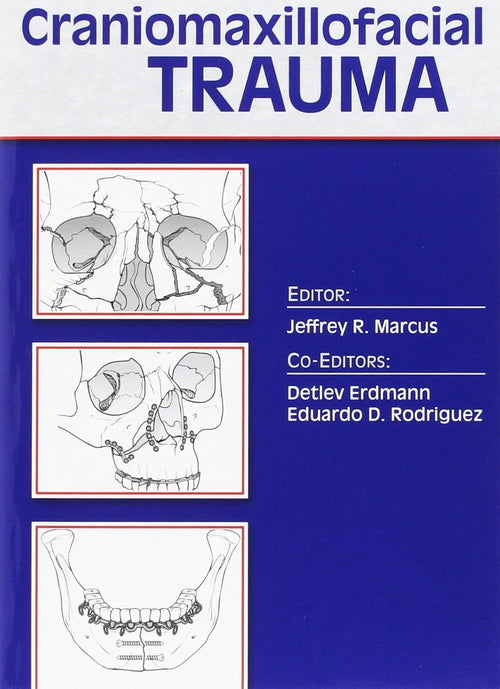 Essentials of Craniomaxillofacial Trauma by Jeffrey Marcus
