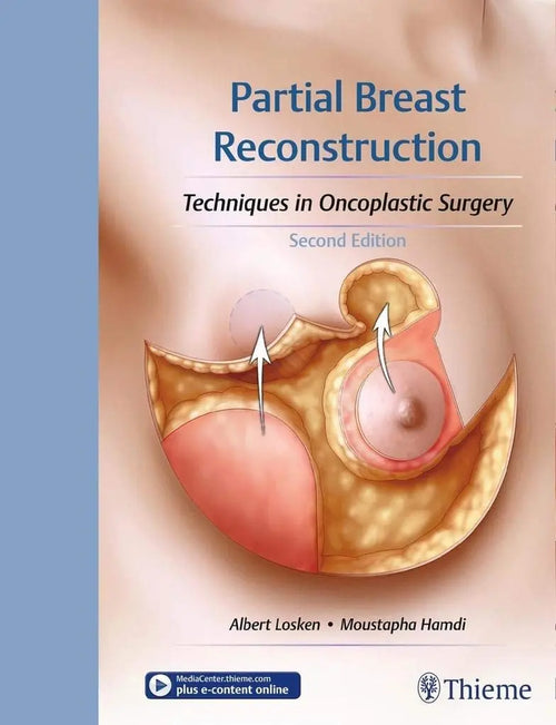 Partial Breast Reconstruction Techniques in Oncoplastic Surgery by Albert Losken