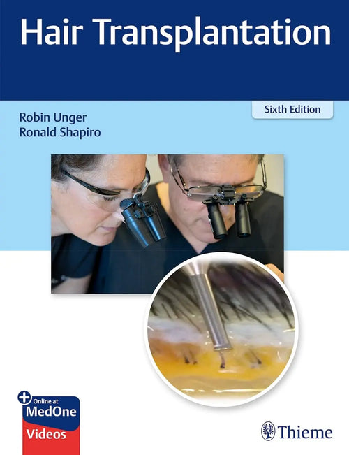 Hair Transplantation by Robin Unger