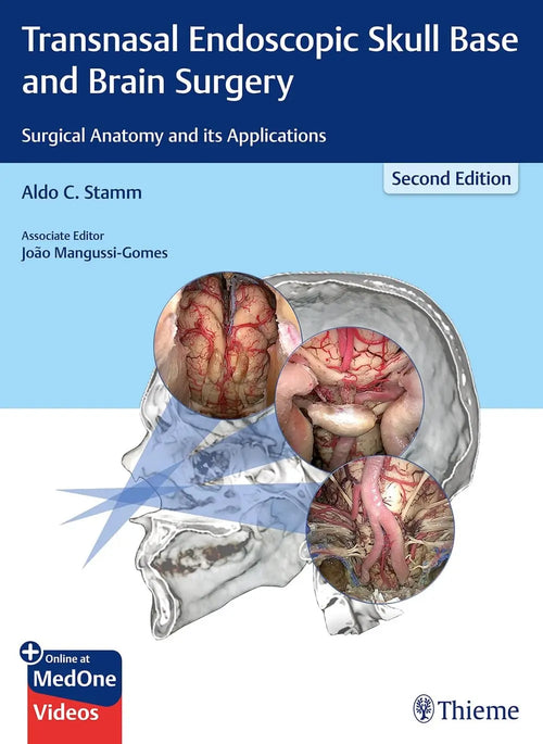 Transnasal Endoscopic Skull Base and Brain Surgery Surgical Anatomy and Its Applications by Aldo C. Stamm