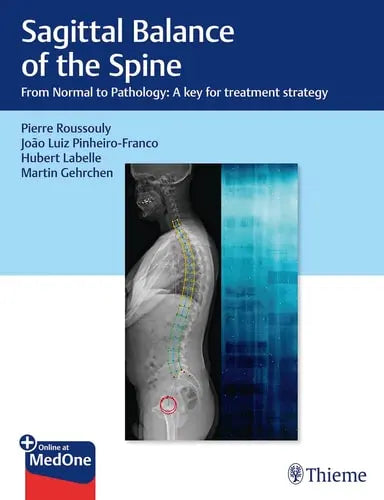 Sagittal Balance of the Spine From Normal to Pathology: A Key for Treatment Strategy