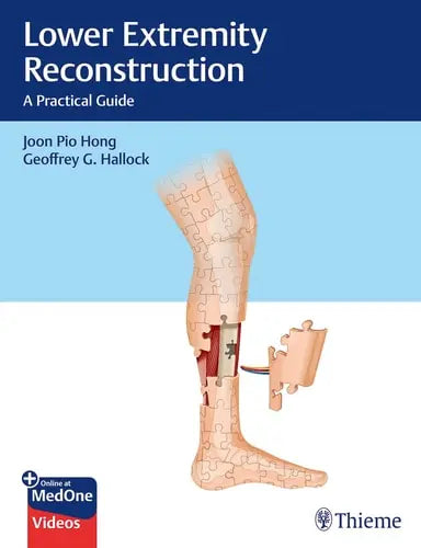 Lower Extremity Reconstruction A Practical Guide Thieme Medical Publishers, Incorporated