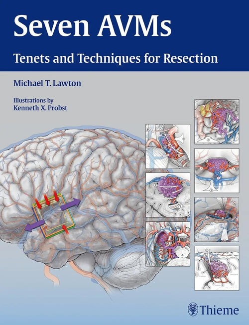 Seven AVMs Tenets and Techniques for Resection by Michael T. Lawton