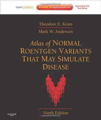 Atlas of Normal Roentgen Variants That May Simulate Disease Expert Consult - Enhanced Online Features and Print Elsevier Health Sciences
