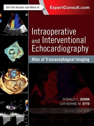 Intraoperative and Interventional Echocardiography Atlas of Transesophageal Imaging – book cover
