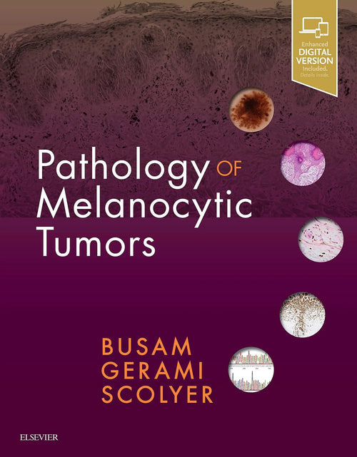 Pathology of Melanocytic Tumors by Klaus J. Busam