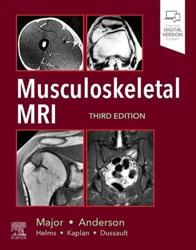 Musculoskeletal MRI Elsevier