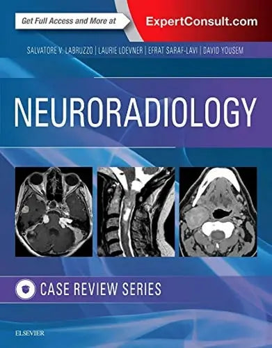 Neuroradiology Imaging Case Review Elsevier