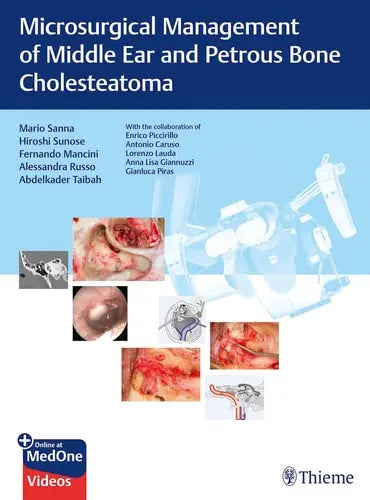 Microsurgical Management of Middle Ear and Petrous Bone Cholesteatoma Thieme Medical Publishers, Incorporated