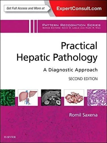 Practical Hepatic Pathology A Diagnostic Approach