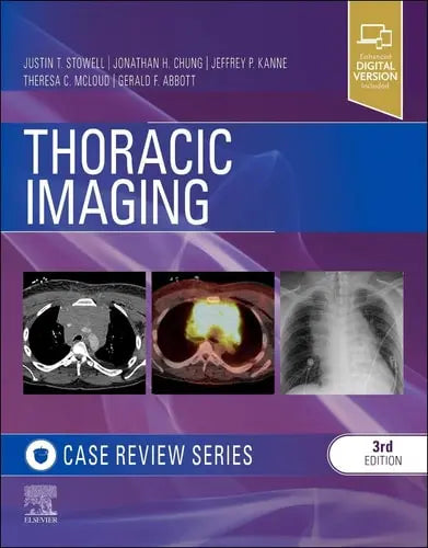 Thoracic Imaging: Case Review Elsevier