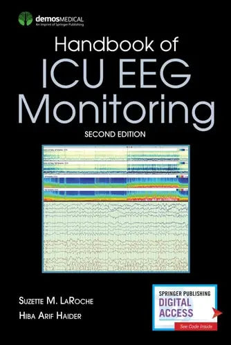 Handbook of ICU EEG Monitoring Springer Publishing Company