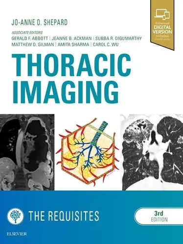Thoracic Imaging the Requisites Elsevier