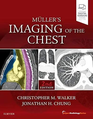 Muller's Imaging of the Chest Expert Radiology Series Elsevier