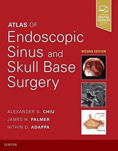 Atlas of Endoscopic Sinus and Skull Base Surgery Elsevier
